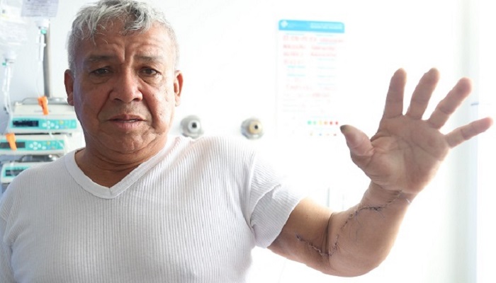Cirujanos del hospital El Tunal le salvan el brazo a hombre con discapacidad